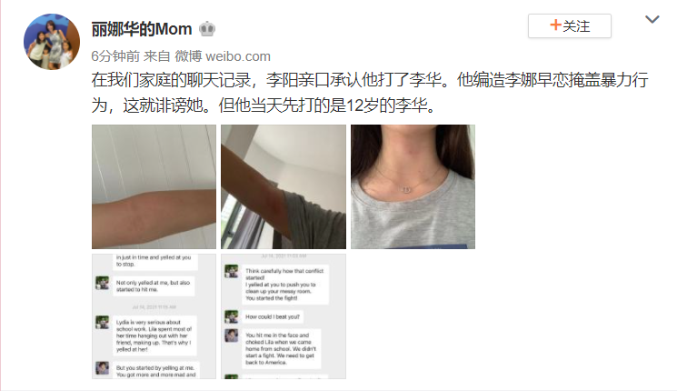 李阳前妻晒女儿伤痕照 称李阳编造谎话掩盖暴力行为